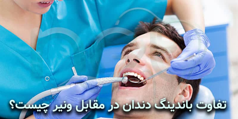 تفاوت باندینگ دندان در مقابل ونیر چیست؟