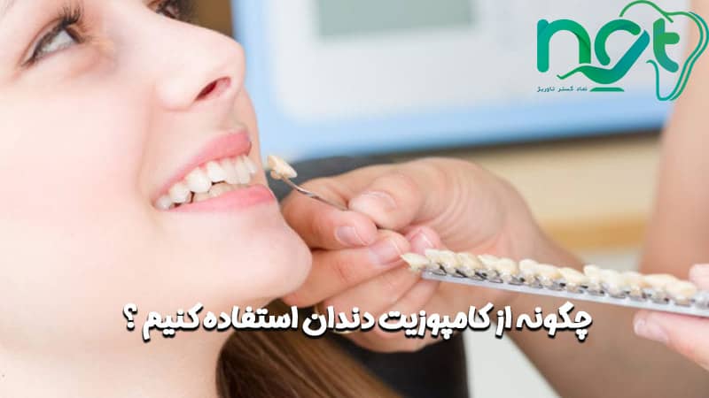  چگونه-از-کامپوزیت-دندان-استفاده-کنیم-؟ 